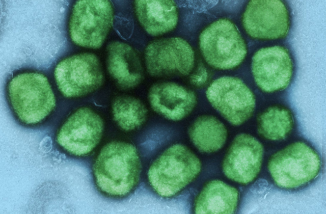 Image of monkeypox virus on slide.