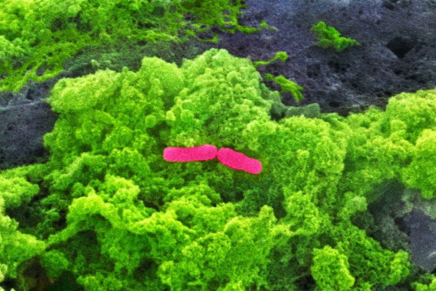 Closeup of green cluster of bacteria cells with pink staining in center.
