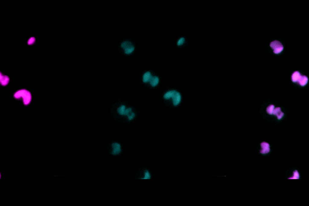 Pink and green specks on a black background depicting co-occurrence of fluorescence from chlorophyll and green fluorescent proteins