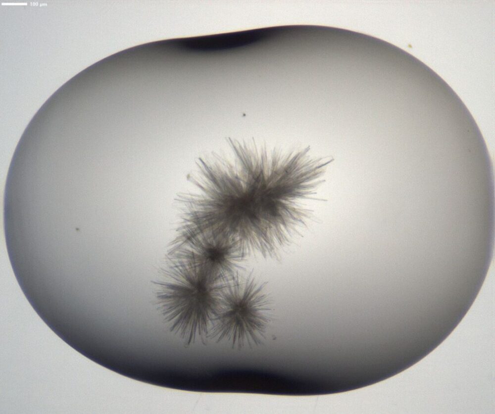 Closeup of black and white hair-like crystals of the PI3Kα protein